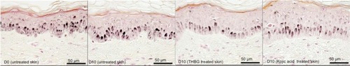 Figure 5 Visualization of melanin content in skin explants cultured in presence or not of THBG at 2% and kojic acid at 1% (histological analysis, Fontana Masson staining).