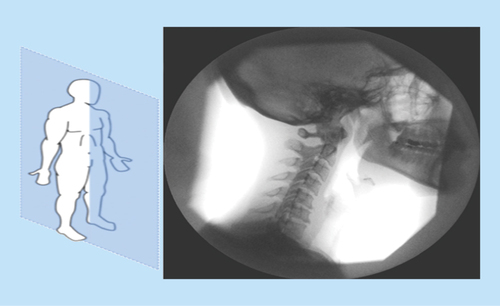 Figure 1.  Vertebra images in sagittal plane.