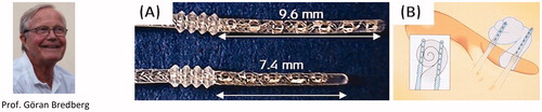 Figure 7. Prof. Göran Bredberg, who proposed the concept of a double branch split electrode. Two-branch split electrode with more extended branch carrying seven contacts, and shorter branch having five contacts (A). Image showing two drilled accesses in upper and lower part of the basal turn, to place the two-branch split electrode arrays (B). Image courtesy of MED-EL.