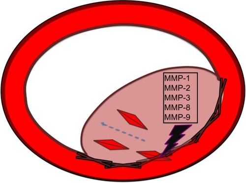 Figure 1 MMPs and smooth-muscle cell proliferation.