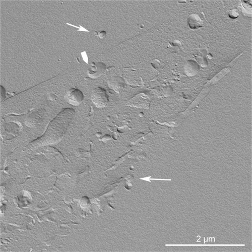 Figure 5 Replica of a cryofixed and cross-fractured human glioblastoma cell, interacting with dimyristoyl-sn-glycero-phosphatidylcholine liposomes. Liposomes (arrows) appear in the extracellular space and the cytoplasm of the cell. Some of them are interacting with cytoplasmic organelles (arrowhead).