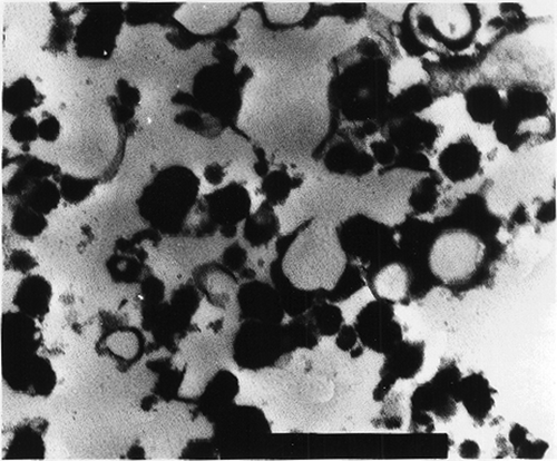 Figure 4 TEM micrograph of Streblus asper milk coagulum (30,000×).