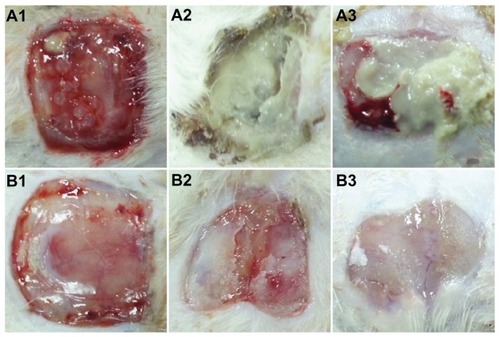 Figure 8 Appearance of wound healing at weeks 1, 2, and 3 after grafting. (A) PLGA/collagen group and (B) PLGA/collagen with vancomycin, gentamicin, and lidocaine group (rectangular wounds 2 cm × 2 cm were prepared on each rat’s back, as shown in A1 and B1).Abbreviation: PLGA, poly(D, L)-lactide-co-glycolide.