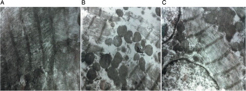 Figure 5. Ultrastructural changes of cardiomyocyte after ADM medication. Images were taken under TEM (×120 00). (A) DMSO control group; (B) ADM group; and (C) ADM with low-Que group.