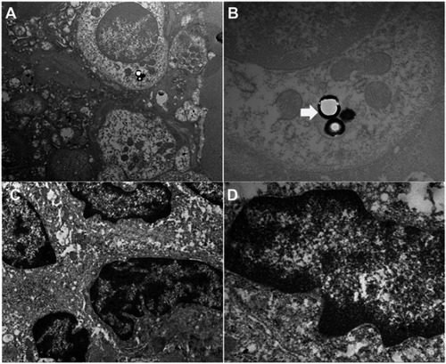 Figure 9 TEM images of treated mice spleen (A, ×6k and B, ×30k) and control group (C, ×15k and D, ×30k) sacrificed 24 hrs post-injection with ZrO2. White arrow indicates ZrO2 particles.