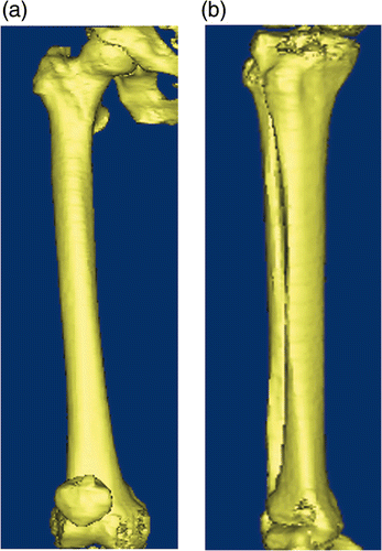Figure 1. 3D model of the knee. (a) Femoral view. (b) Tibial view.