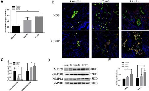 Figure 1 M2 macrophage numbers are increased in COPD patients. Con-NS, nonsmokers without COPD; Con-S, smokers without COPD; COPD, COPD patients. (A) The increased numbers of lung macrophages were assessed by immunofluorescence. (B) Immunofluorescence analysis of lung sections in the Con-NS (n=4), Con-S (n=5), and COPD (n=6) groups. Scale bars, 50 μm. CD68: green; iNOS: red; CD206: red. (C) Quantification of the ratio of M1 or M2 macrophages to the total number of macrophages. Total macrophages: CD68+. M1: CD68+ and iNOS+. M2: CD68+ and CD206+. (D) Western blots. (E) Relative protein levels of MMP9 and MMP12 in the lung were determined. The data are the mean ± SD (n=3). *P<0.05; **P < 0.01.