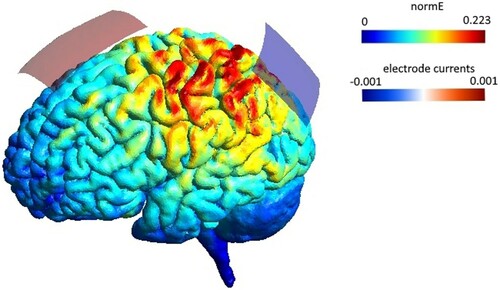 Figure 1. Electrode montage and simulated current flow, performed with SimNIBS 3.1.0 (Thielscher et al., Citation2015). The 5 × 7 cm anode was positioned just anterior to the vertex (Cz) and the 5 × 5 cm cathode positioned over the left parietal cortex (P3). The normalized induced electric field (normE) is shown in V/m and the current induced by each electrode in mA.