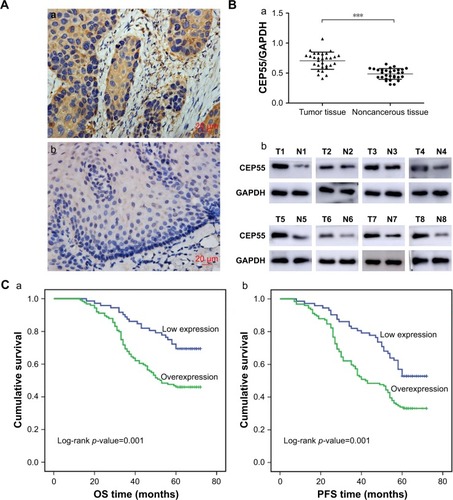 Figure 1 Expression of CEP55 in ESCC and its relationship with OS and PFS.