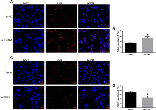 Figure 3. FOXK1 inhibits the DNA synthesis capacity of GCs in PCOS rats. (A,B) EDU staining was used to detect the effect of silencing FOXK1 on the ability of GCs DNA synthesis in PCOS rats. (C,D) EDU staining was used to detect the effect of overexpression of FOXK1 on the ability of GCs DNA synthesis in PCOS rats. Magnification, 200×. n = 3, compared to the vector group, ▲p < .05, ▲▲p < .01.