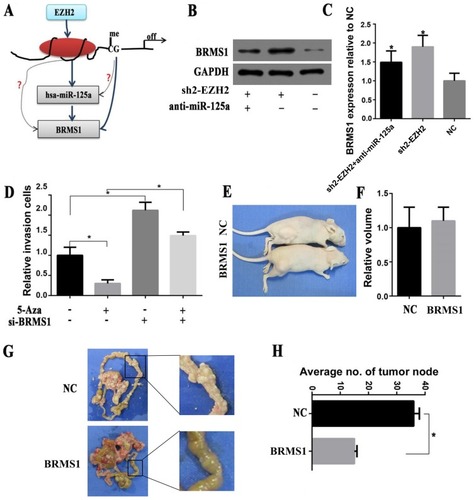 Figure 5 Epigenetic regulation of the miR-125a/BRMS 1 axis to promote GC invasion and metastasis in vitro and in vivo. (A) Working model for the regulation of the miR-125a/BRMS1 axis by EZH2 in GC. (B and C) Western blot analysis of the expression of BRMS1 treated with/without Sh2-EZH2/anti-miR-125a. (D) Invasion assay analysis of the invasive cells in SGC-7901 cells treated with/without 5-Aza/siBRMS1. (E and F) Representative images of metastatic tumors in nude mice inoculated with NC/shBRMS1. The volume of metastatic tumors between NC and shBRMS1 was no significantly different (P>0.05). (G and H) Representative images of metastatic tumors in the mesentery and intestine of nude mice inoculated with NC/shBRMS1. The number of tumor nodes was significantly lower in the siBRMS1 group than in the NC group (P<0.05). *P<0.05.