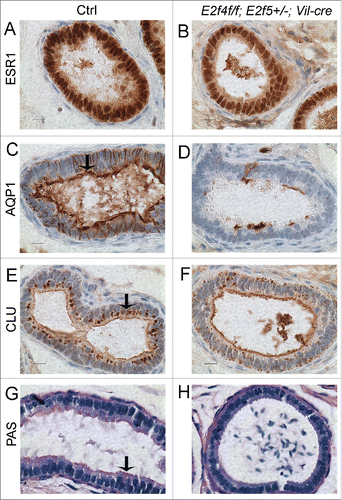 Figure 4. Efferent duct marker analyses indicates abnormal development of the adult E2f4f/f;E2f5+/−;Vil-cre efferent duct epithelium. (A) Immunohistochemical analysis of estrogen receptor 1 (ESR1) expression (brown stain) in control and (B) mutant efferent ducts showing reduced expression in the mutants. (C) Aquaproin 1 (AQP1) expression (brown stain) is predominantly at the apical surface of control efferent ducts (arrow) but poorly expressed in the mutants (D). (E) Clusterin (CLU) a marker for the endocytic apparatus is located predominantly beneath the apical surface in controls (arrow) but poorly expressed in mutant efferent ducts (F). (G) Sections submitted to the PAS reaction show apical staining in the controls but not in the mutants (H) indicating a loss of endocytic apparatus. Scale bars in all panels 10 μm.