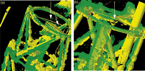Figure 4. (a) For patient 2, the top frame and proximal tibia are well aligned when the top frame only is used for the registration (FVOL-1) (yellow: CT-A from first scan date; green: FVOL-1). However, the proximal pins (white arrows) are clearly not aligned. (b) The proximal tibia and pins are then used to align the proximal tibia (FVOL-3). This results in the pins (white arrow) and proximal tibia being better aligned, but the top frame (magenta arrow) is no longer aligned (yellow: CT-A from first date; green: FVOL-3).