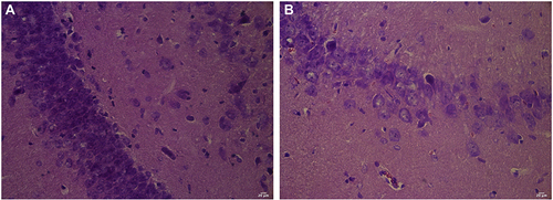 Figure 2 (A) Hippocampus of rats in the control group (HE). (B) Hippocampus of rats in the experimental group (HE).