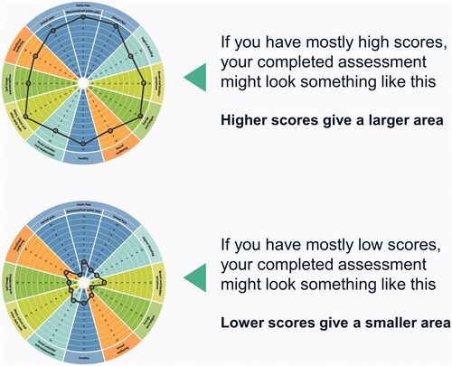 Figure 3. Examples of possible completed EndoWheel assessments. The size of the area formed from connecting the scores in each domain allows for visualization of the disease burden.