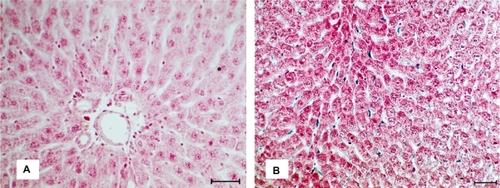 Figure 3 A) Micrograph of liver colored by the Prussian blue from tissues of control animals. B) Micrograph of liver after the SPIONs administration, making evident the presence of the nanoparticles in the tissue; bar = 40 μm.Abbreviation: SPIONs, superparamagnetic iron oxide nanoparticles.