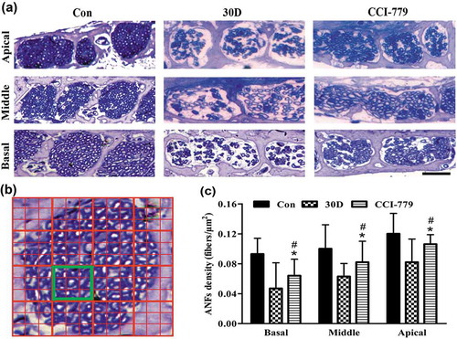 Figure 10. The degenerative rate of auditory nerve fibers was also significantly reduced with the CCI-779 intervention. (a and c) Compared with that of the negative control group, light microscopy observation of toluidine blue staining revealed that the nerve fiber density in the habenula perforata of the experimental group was significantly higher in the apical, middle and basal turns. (b) A diagram model of the calculated auditory nerve fiber density. The number of axons in the yellow box was counted. The size of the yellow box is 0.01 mm x 0.01 mm. The density of auditory nerve fibers (ANFs) was determined by the number of axons/100 μm2. *, the difference between the experimental group and the blank control group was significant (P < 0.05); #, the difference between the experimental group and the negative control group was significant (P < 0.05); CCI-779, experimental group; 30D, negative control group; Con, blank control group. Scale bar: 25 µm.