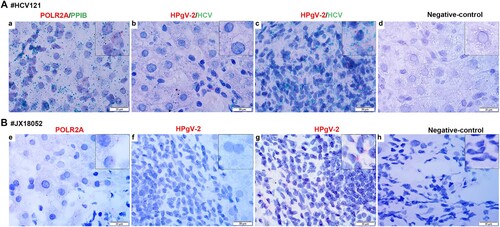 Figure 5. Detection of HPgV-2 and HCV RNA in liver tissues using RNAscope in situ hybridization. Liver slices were collected from HCV and HPgV-2 co-infected patients: patient HCV121 before DAA treatment (A) and patient JX18052 after DAA treatment (B). The specific probes for host gene POLR2A and PPIB were used as positive controls (a, e). For patient HCV121, HCV RNA (green) was detected in hepatocytes (b) and infiltrative lymphocytes (c), while HPgV-2 RNA (red) was only found in infiltrative lymphocytes (c). For patient JX18052, HPgV-2 RNA was detected in the infiltrative lymphocytes (g), but not in the hepatocytes (f). Non-specific probes were used as the negative controls (d, h). The size of the bar is 20 µm.