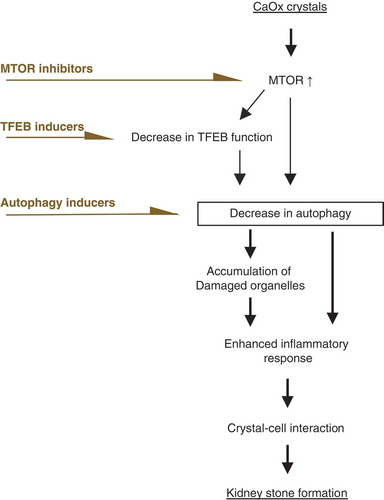 Figure 8. Deregulated MTOR-TFEB axis could be an effective target for kidney stone formation. During kidney stone development, MTOR is activated and nuclear TFEB expression is suppressed, impairing autophagy. Ablation of autophagy causes accumulation of damaged organelles. This enhances the inflammatory response, which facilitates crystal-cell interactions and promotes kidney stone formation. Therefore, autophagy defect caused by deregulation of the MTOR-TFEB axis could be an effective target for kidney stone formation. An MTOR inhibitor, TFEB inducer, or autophagy inducer could suppress the development of kidney stones.