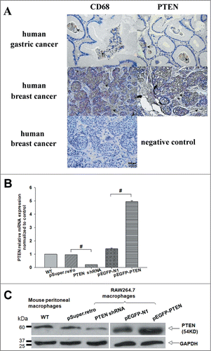 Figure 1. Tumor-associated macrophages (Mφ) differentially expressed PTEN in vivo and in vitro. (A) Distinct expression patterns of tumor-infiltrating CD68-positive and PTEN-positive cells in human tumor samples. Consecutive sections of gastric or breast carcinoma were used for immunohistochemical identification of CD68- positive and PTEN-positive cells. Positive cells were stained brown, nonspecific immunoglobulin was used as a negative control. (B, C) The level of PTEN in primary macrophages and RAW 264.7 cells transfected with shRNA and pEGFP specific for mouse PTEN or the negative control were analyzed by Q-PCR and WB, GAPDH was used as an internal control.