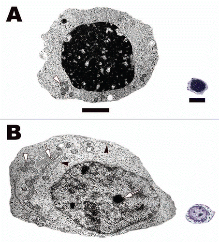 Figure 9 Spermatogonia representatives from the alligator (Alligator mississippiensis), lizard (Podarcis muralis) and snake (Seminatrix pygaea) at the light and electron microscope level. Notice how similar is morphology the cell types are at both levels of microscopy. The have similar nuclear morphology, nucleoli present (black arrow), and the same organelle distribution cytoplasmically: mitochondria, mi; endoplasmic reticula, er. Light: Bar = 20 µm, TEM: Bar = 5 µm.