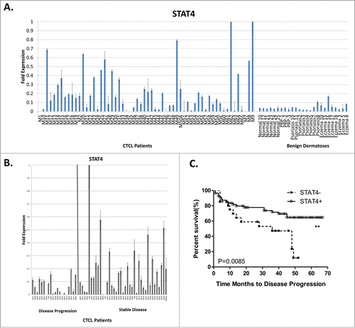 Figure 3. (A) STAT4 is preferentially expressed in CTCL lesional skin compared to benign inflammatory dermatoses or normal skin from healthy volunteers. (B) Within the CTCL skin samples STAT4 low expression is observed in patients with progressive disease. (C) Kaplan-Meier analysis documented that loss of STAT4 expression is associated with poor disease prognosis.