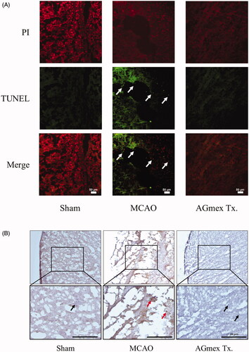 Figure 6. Effects of double pre-treatment (at 1 h and 24 h pre-MCAO) with AGmex at 1000 mg/kg on MCAO-induced cell death. (A) Representative images of TUNEL and PI double-stained cerebral cortex regions showing MCAO-induced apoptosis; white arrows indicate neurons showing apoptotic changes (scale bars: 50 µm). (B) Representative images of IHC staining of MCAO-induced changes in mTOR (mammalian target of rapamycin) protein expression in the cerebral subcortical regions of tMCAO-induced mice; red arrows indicate mTOR positivity, and black arrows indicate mTOR negativity (scale bars: 20 µm).