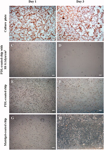 Figure 6. The morphological changes of T98G cells treated with 1 μg/mL DOX on the different cell culture platforms: a 2D cell culture plate, shear stress (SS) chip, PDL-coated chip or Matrigel-coated chip. When DOX treatment was administered, the cells did not proliferate in the culture dish; the lamellipodia and filopodia were not protruding from the cell body and the cell morphology changed to an aberrant form. In the microfluidic chip coated with PDL, T98G cells were almost completely washed out. This result suggests that the cells that lost their binding ability were separated by the flow. On the other hand, despite the DOX treatment in the Matrigel-coated chip, the morphology was unchanged and cell proliferation was observed (scale bar: 200 μm).