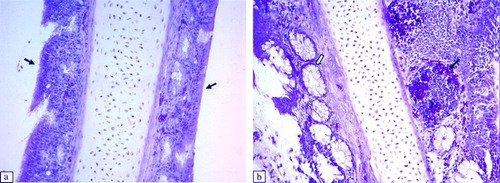 Figure 3.  Histopathological lesions in the nasal turbinate at 6 d.p.i. (H & E stain, 200x magnification). 3a: Intact ciliated epithelium of a control broiler (arrows). 3b: Nasal turbinate of an aMPV subtype-B-inoculated broiler showing infiltration of lymphoid cells in the epithelium (black arrow) and hypertrophy of the mucous gland (white arrow) (score 3). Nasal turbinates of aMPV subtype-A-inoculated broilers show similar lesions.