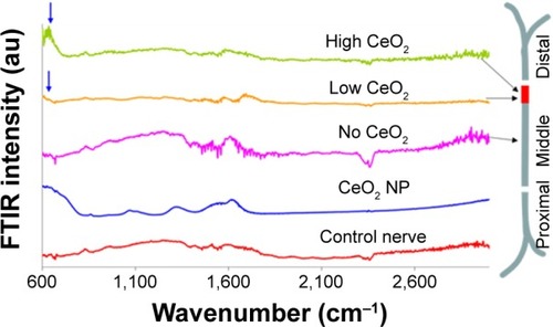 Figure 2 FTIR traces from different regions of CeO2-treated sciatic nerve of the frog.Notes: Arrows indicate CeO2 presence compared to control (CeO2 NP). Peaks approximately 1,640 cm−1 are attributed to the ν2′ band of the hydrogen bond of water.Abbreviations: FTIR, Fourier transform infrared microscopy; NP, nanoparticle.