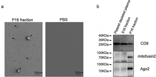 Figure 4. P16 fraction analysis. (a) Visualization of nanosized objects in P16 fraction and control PBS buffer using low-voltage scanning electron microscopy (LVSEM). Arrowheads and arrows indicate nanosized near-spherical objects in P16 fraction. (b) Immunoblotting based detection of CD9, Mitofusin2 and Ago2 proteins in platelet-depleted plasma and its fractions S16 and P16.