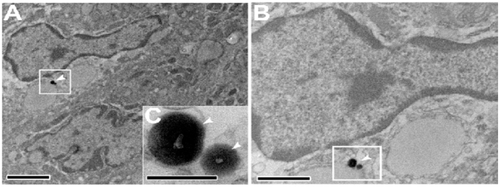 Figure S1. Electron photomicrographs showing the colocalization of Rh130 thiol-organosilica particles and PP SED cells.Note: Scale bar = (A) 2 μm; (B) 1 μm; (C) 200 nm.Abbreviations: PPs, Peyer’s patches; Rh, rhodamine B; SED, subepithelial dome.