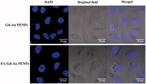 Figure 3. Confocal microscopic images of HeLa cells treated with the FA-Gd-Au PENPs and nontargeted Gd-Au PENPs ([Au] = 100 μM) for 12 h. The white frame refers to the cytophagic particles.