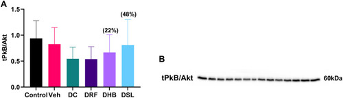 Figure 4 Total protein expression of PkB/Akt. (A) Graph of PkB/Akt, (B) probed blot of PkB/Akt. Values in bracket () denotes percentage change versus DC. n=4–5.