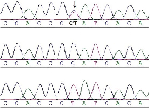 Figure 1. Sequencing map of three genotypes of the rabbit CAST gene in the intron 3 region.