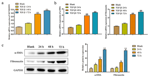 Figure 2. The KCNQ1OT1 expression was decreased in TGF-β-induced HK-2 cells. (a) The KCNQ1OT1 expression in TGF-β-induced HK-2 cells from 0 h to72 h. (b, c) The mRNA and protein expressions of α-SMA and Fibronectin with treatment with TGF-β (10 ng/ml) was detected by RT-PCR and western blot analyses. All results were presented as mean ± SD from at least three independent experiments. *P < 0.05, **P < 0.01 vs. Blank.