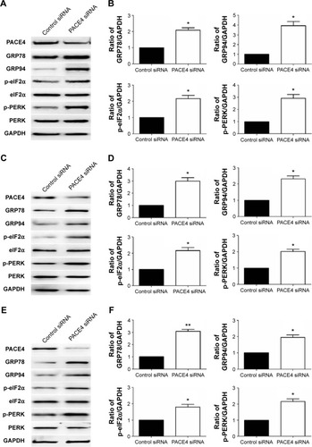 Figure 6 Effects of PACE4 siRNA on ER stress-associated proteins in prostate cancer cells.