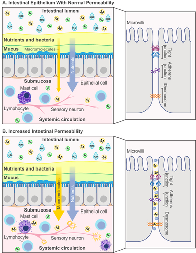 Figure 1 Schematic diagram of the intestinal epithelium with (A) normal permeability, and (B) increased permeability. (A) In normal intestinal epithelium, nutrients are absorbed from the lumen of the intestine into systemic circulation by passive, or paracellular, transport between the intercellular spaces. Tight junction proteins interconnecting the epithelial cells stop the transport of macromolecules from the lumen into systemic circulation. (B) In intestinal epithelium with increased permeability, the tight junction complex is disrupted and allow paracellular transport of macromolecules. They may activate mucosal mast cells to produce an inflammatory response, which can excite TRPV1-expressing sensory neurons, leading to increased visceral hypersensitivity and abdominal pain.
