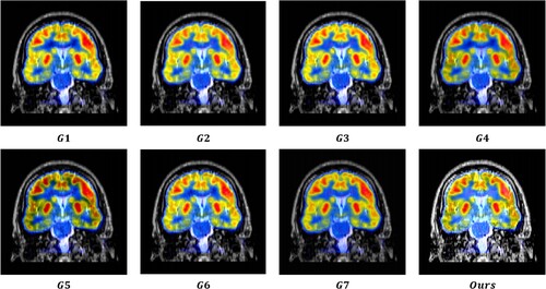 Figure 18. Results obtained from eight image fusion algorithms for MRI-PET image pair #068C in K3.