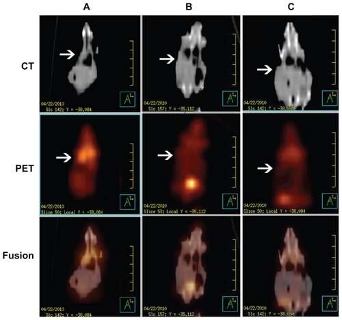 Figure 6 PET/CT images of mice administered 100 μCi of 18F-FDG and scanned 30 minutes post injection. From up to down, CT, PET and fusion views. (A) Taxotere® (10 mg/kg DOC equal). (B) DOC-NPs (10 mg/kg DOC equal). (C) DOC-TNPs (10 mg/kg DOC equal).Abbreviations: CT, computed tomography; DOC, docetaxel; DOC-NPs, docetaxel-loaded nanoparticles; DOC-TNPs, tumor-targeted docetaxel-loaded nanoparticles; PCL, poly(ɛ-caprolactone); PEG, poly(ethylene glycol); Pep, peptide; PET, positron emission tomography.