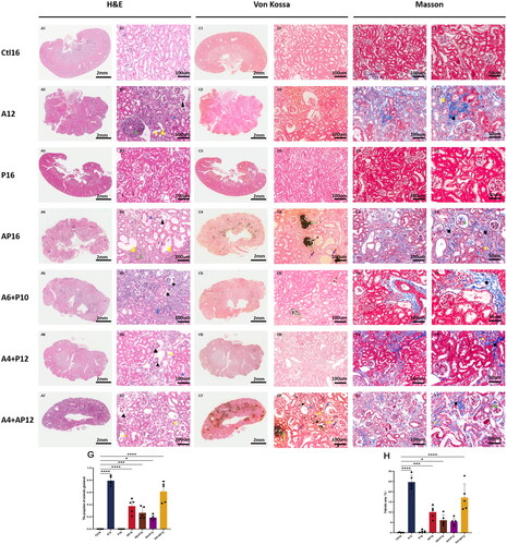 Figure 4. Representative histopathological images in renal tissues from different groups and semiquantitative analyses of glomerulus sclerosis and interstitial fibrosis. Renal tissues were evaluated in each group using hematoxylin and eosin (H&E) (A1–7, B1–7), von Kossa (C1–7, D1–7), and Masson staining (E1–7, F1–7). Invasion of inflammatory cells (green triangle), tubular luminal expansion (yellow triangle), protein casts (blue triangle and yellow square), contracted glomerular capillary tuft (black triangle), calcified deposits in the tubulointerstitial compartment including tubular lumen (green arrowhead) and interstitial (violet arrowhead), calcification in tubular basement membrane (yellow arrowhead), parietal layer of renal capsule (blue arrowhead), and renal small arteries (black arrowhead), interstitial fibrosis (black square), matrix deposition in glomerular capillary tuft (green square). Semiquantitative analyses of kidney injury were performed according to the proportion of sclerotic glomeruli based on H&E staining (G) and the percentage of fibrotic area based on Masson staining (H). the proportion of sclerotic glomeruli were calculated as the number of sclerotic glomeruli divided by the total number of glomeruli in the same 200× field view. Fibrotic area and the total renal tissue area were measured using Image-Pro plus (version 6.0). Data are the mean ± SEM. ****p<0.0001, ***p< 0.001, **p<0.01, *p<0.05 vs Ctl16, determined by ANOVA with Bonferroni multiple comparison test. N = 5/each group.