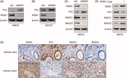 Figure 5. RDM1 regulates p53-RAD51-RAD52 in human ovarian carcinoma cells. (A,B) Protein expression of P53 and RDM1 were detected by western blotting assay in H8910 or SKOV3 siRDM1/siN cells. (C,D) Protein expression of RDM1, P53 RAD51, and RAD52 were detected by western blotting assay in H8910 or SKOV3 siRDM1/siN cells. (E) Representative IHC images showing immunostaining of RDM1, P53 RAD51, and RAD52 in human normal ovary or ovarian tumour tissues.