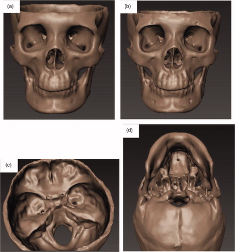 Figure 10. Make the features more obvious. a) The original digital model before manipulation in the Mudbox; b) We deepen the holes, such as supra-orbital foramen and infra-orbital foramen and the cheek part, which are not obvious before the operation; c) We repair the anterior clinoid and make them more obvious; d) We create two mastoid processes. (The size of anterior clinoid in the digital model is too small to show and to print accurately).