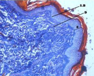 Figure 4. Stratum spinosum (S.S), stratum cornium (S.C), stratum basali, epidermis and dermis and Keratin layer in Ayoub Schklar X 200.