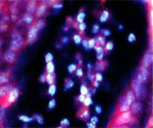 Figure 4 Enterococcus bacteria present in intracryptic abscess in intestines of group IV mice.