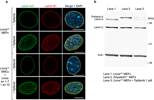 Figure 5. Nuclear lamin distribution in mouse embryonic fibroblasts (MEFs) that had been cultured in the presence of a protein farnesyltransferase inhibitor (FTI). (a) Confocal micrographs of Lmna+/+ MEFs and Lmna–/– SMCs that expressed the exon 1–7 + exon 12 lamin A (cultured in the presence or absence of 1 µM tipifarnib). Scale bars, 10 µm. (b) A western blot, with antibodies against lamin A/C and actin, of cell extracts from Lmna+/+ MEFs, Zmpste24–/– MEFs, and Lmna+/+ MEFs that had been incubated with 1 µM tipifarnib.