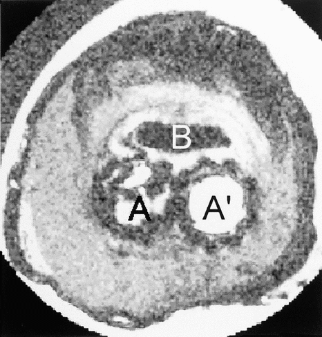 Figure 8 T2 weighted MR images.