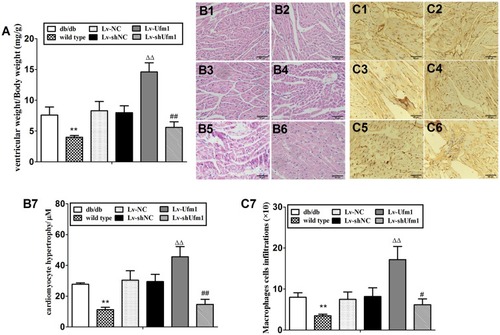 Figure 10 Effects of Ufm1 on diabetic cardiomyopathy in db/db mice. (A). Ventricular index; (B) Representative myocardial pathological pictures of the wild-type (B1), db/db (B2), Lv-NC (B3), Lv-shNC (B4), Lv-Ufm1 (B5) and Lv-shUfm1 groups (B6); (B7) shows the pathological scores of each group; (C) Representative renal immunohistochemical pictures of the wild-type (C1), db/db (C2), Lv-NC (C3), Lv-shNC (C4), Lv-Ufm1 (C5) and Lv-shUfm1 groups (C6); (C7) shows the numbers of positive macrophages in each group. The data are presented as the mean±SD, n=6. **P<0.01 compared to the wild-type group; ΔΔP<0.01 compared to the Lv-NC group; #P<0.05, ##P<0.01 compared to the Lv-shNC group.