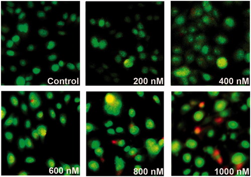 Figure 6. The patterns of cell damage were assessed using an acridine orange/ethidium bromide differential staining method. Images show AO/EtBr staining of control and MRPE cells treated with various doses of ZnS-NPs. Green cells indicate live cells and red or yellow–red indicate apoptotic cells. All experiments were repeated three times with similar results.