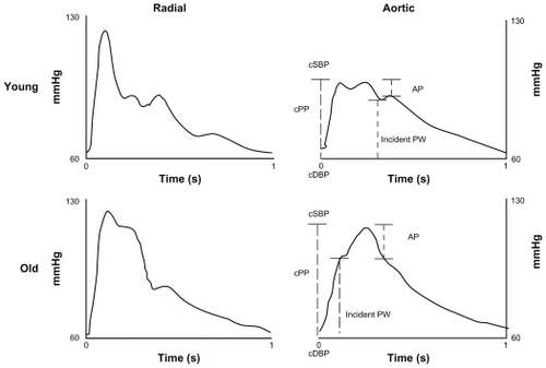 Figure 1 Radial (left) and aortic (right) waveforms in a young and an old subject.